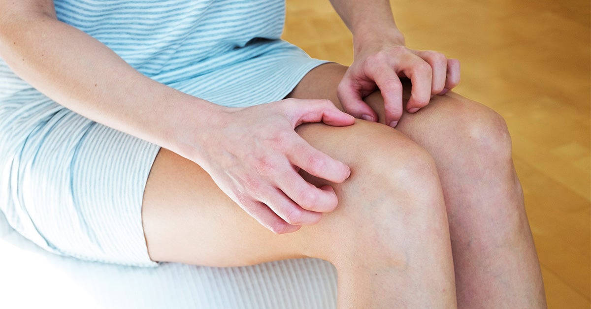 How to Get Rid of a Rash Between Your Legs: At-Home Treatments & More