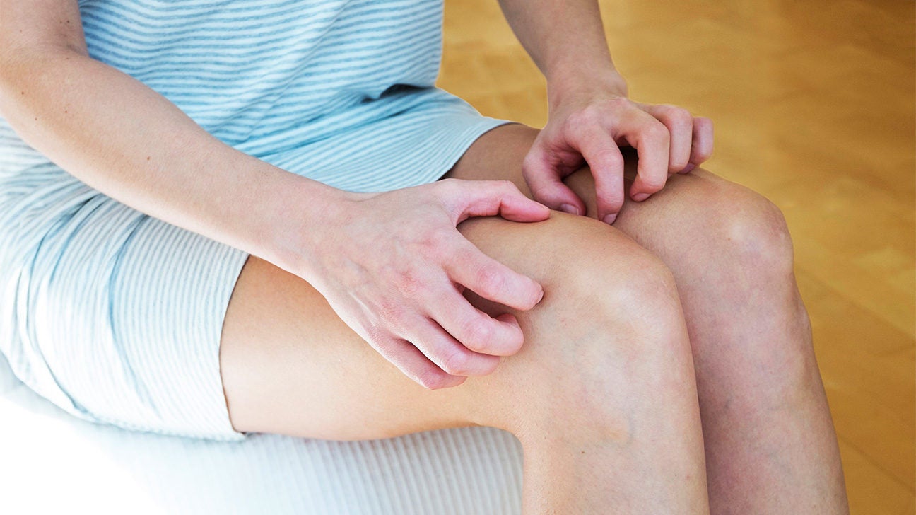 How to Clear Black Rashes from The Inner Thigh