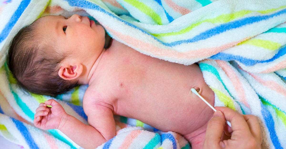 newborn belly button after cord falls off