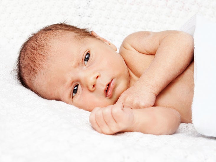 High Bilirubin Levels In Newborns Chart