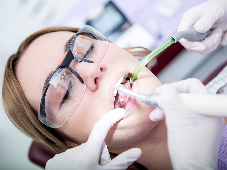 Root Canal on Front Tooth: Procedure, Cost, and More