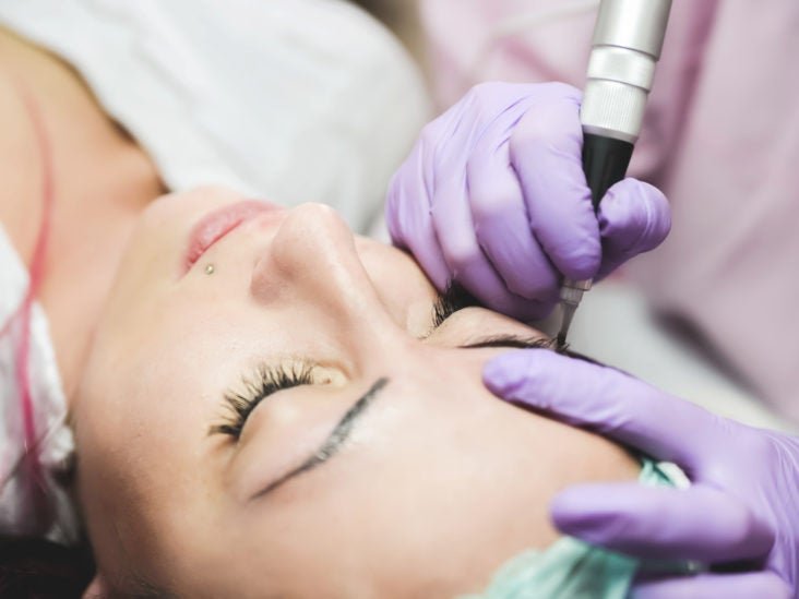 Does Microblading Hurt? What to Expect from the Procedure