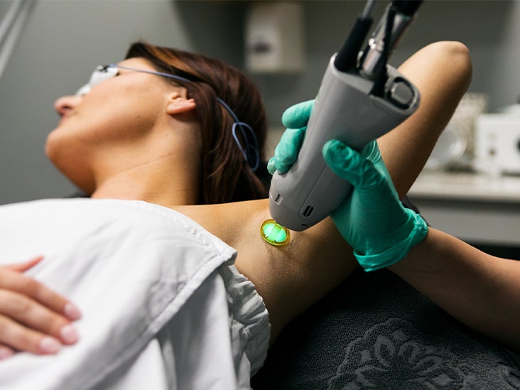Laser Hair Removal on the Face: Cost, Procedure, and More