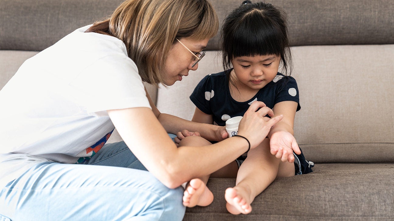 Gnat Bites Treatment Options and Prevention Tips