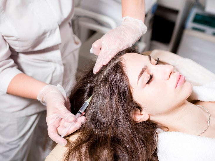 Hair Regrowth Injections  Explained