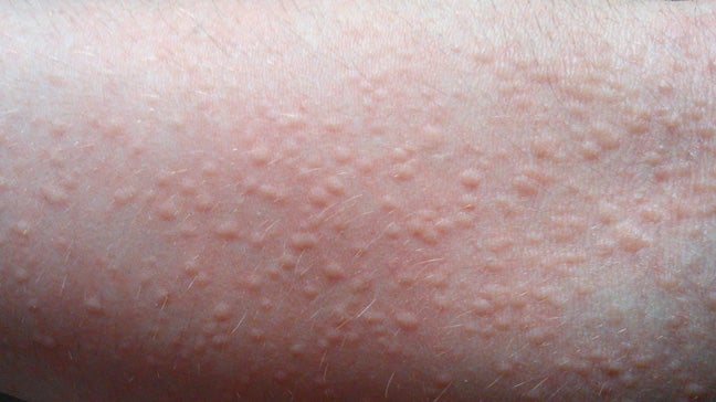 What's Causing Your Itchy Skin? (with Pictures)