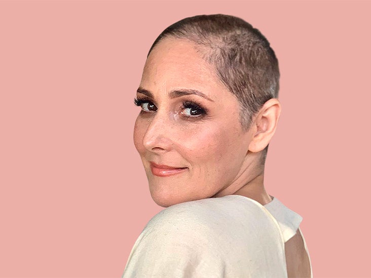 How You Can Cope If You Have Hair Loss Like Ricki Lake