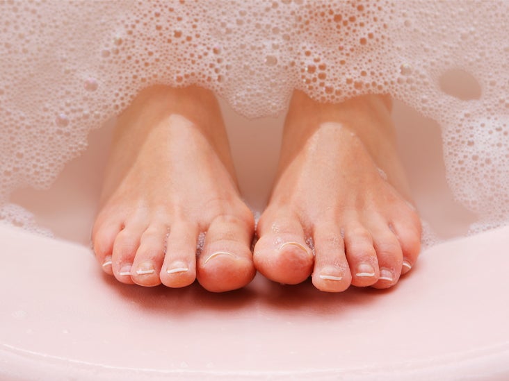 dry skin foot peel