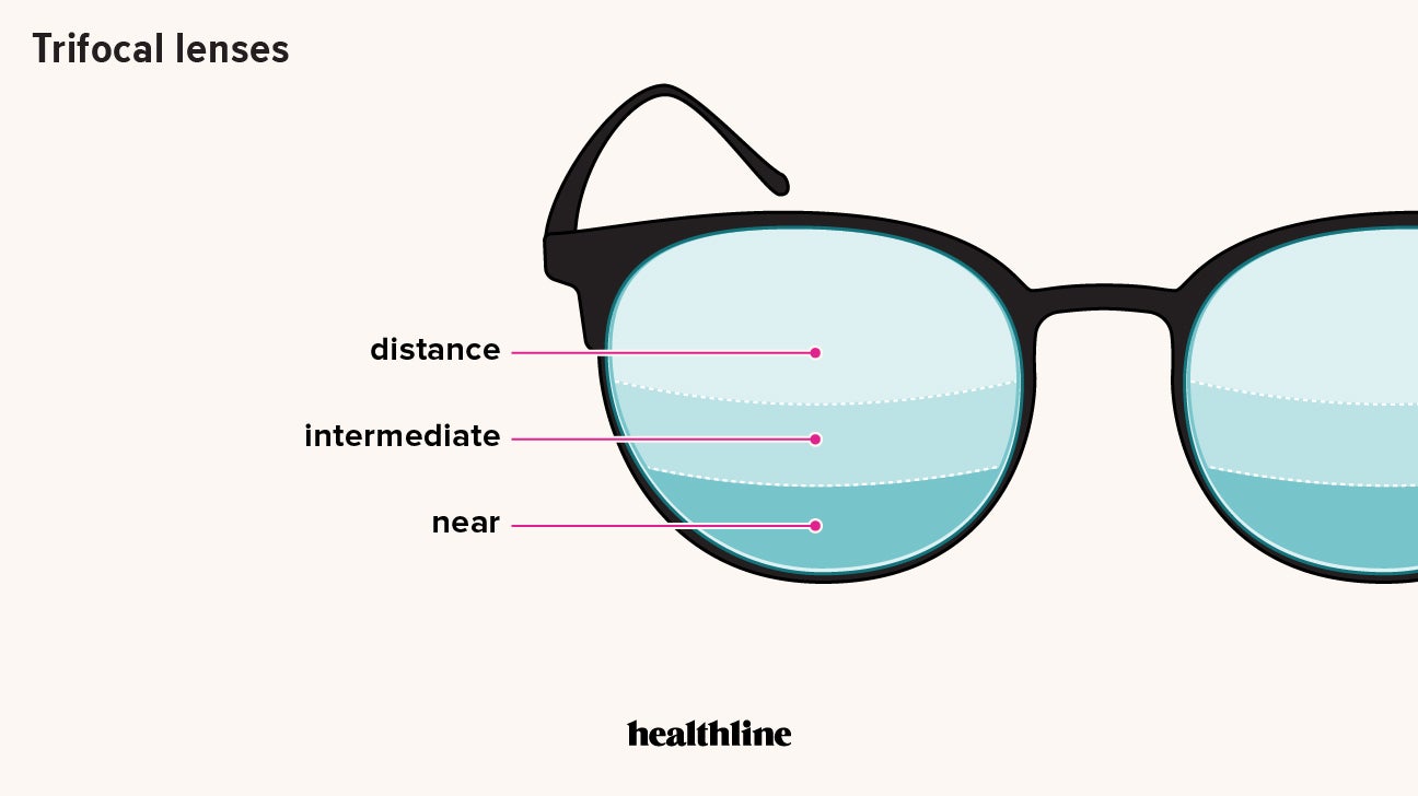 Trifocal Lenses: Uses, Benefits, Costs, and Comparison to Bifocals