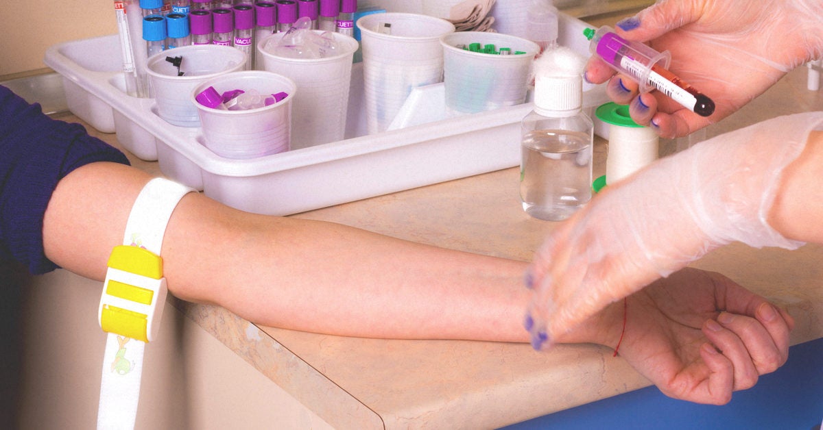 blood-test-for-fibromyalgia-what-you-need-to-know