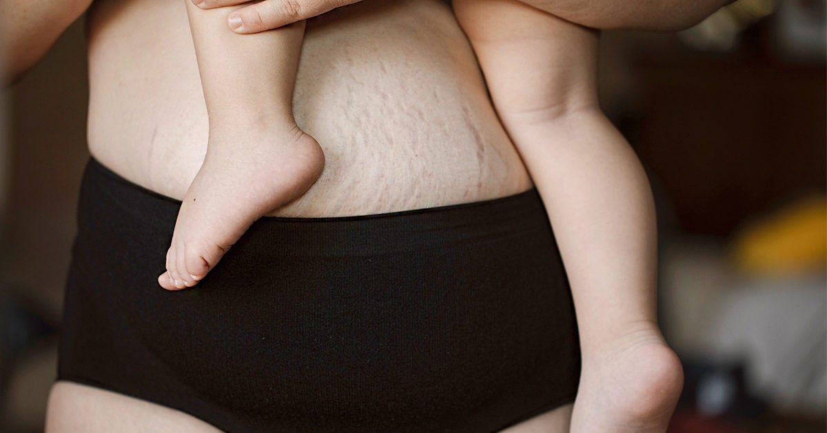 Not Just Mesh Panties: Postpartum Underwear Options You'll Love