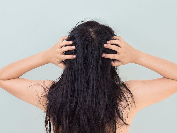 Finding Nits but No Lice in Your Hair: What to Do Next