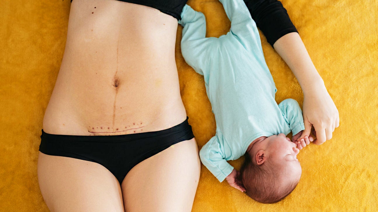 Fashion Postpartum C-Section Post Pregnancy Belly Belt Birth