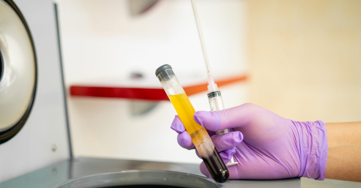 Platelet-Rich Plasma for the Knee: Does It Work?