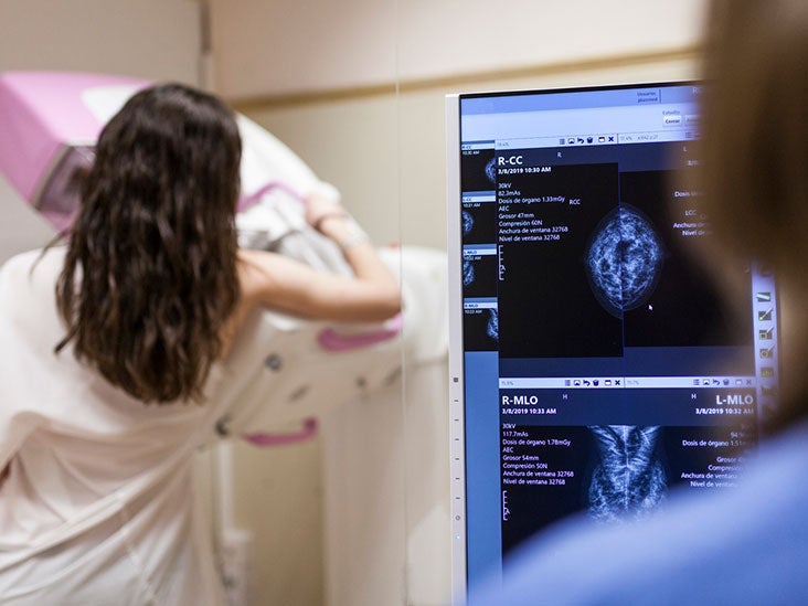How Often Should You Get a Mammogram?