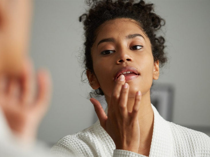 Can Vitamin Deficiencies Cause Chapped Lips?