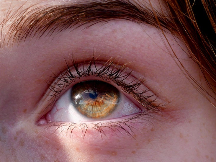 Lazy Eye: Causes, Symptoms, and Diagnosis