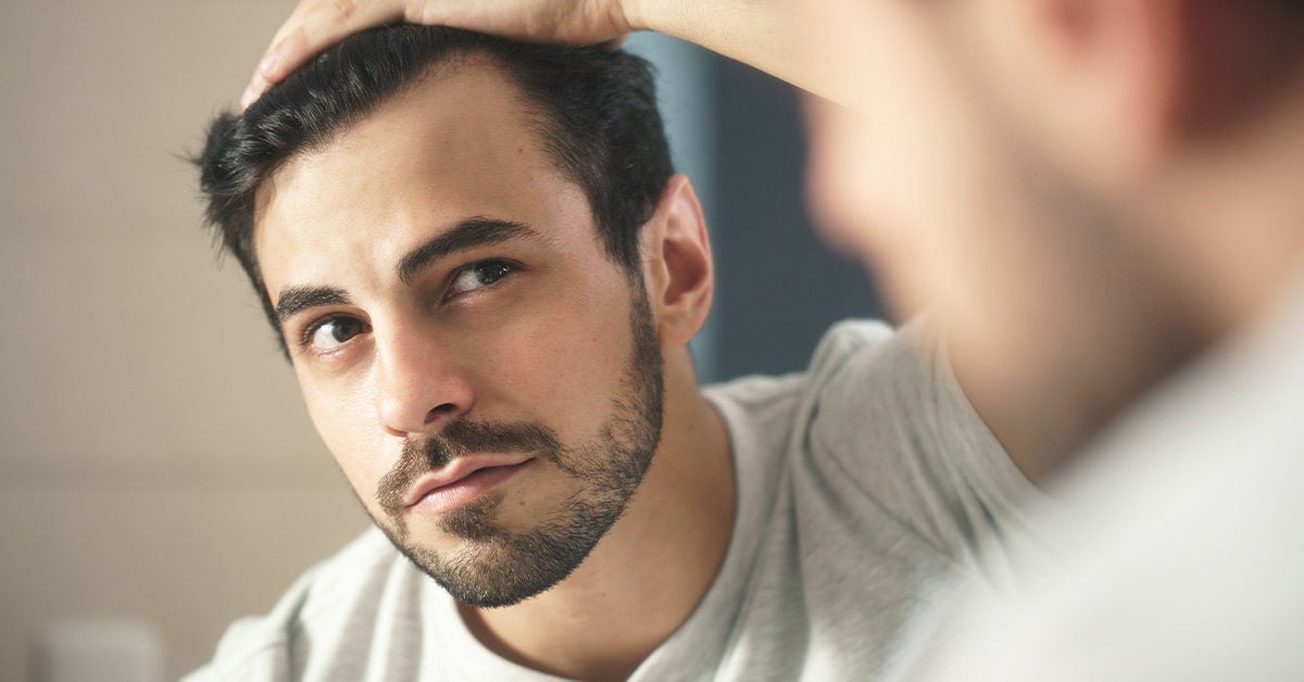 Hairline Restoration: What You Can Do Now