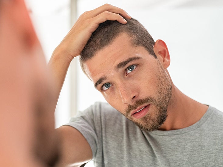 Frizzy Hair in Men: Causes, Treatment, and Prevention