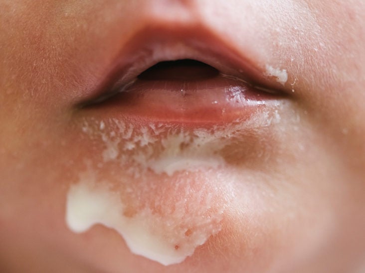 baby spitting milk