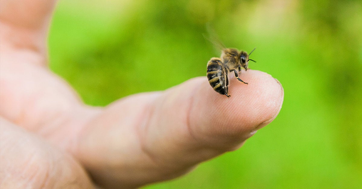 How To Remove A Bee Stinger Wasp Stinger Or Hornet Stinger