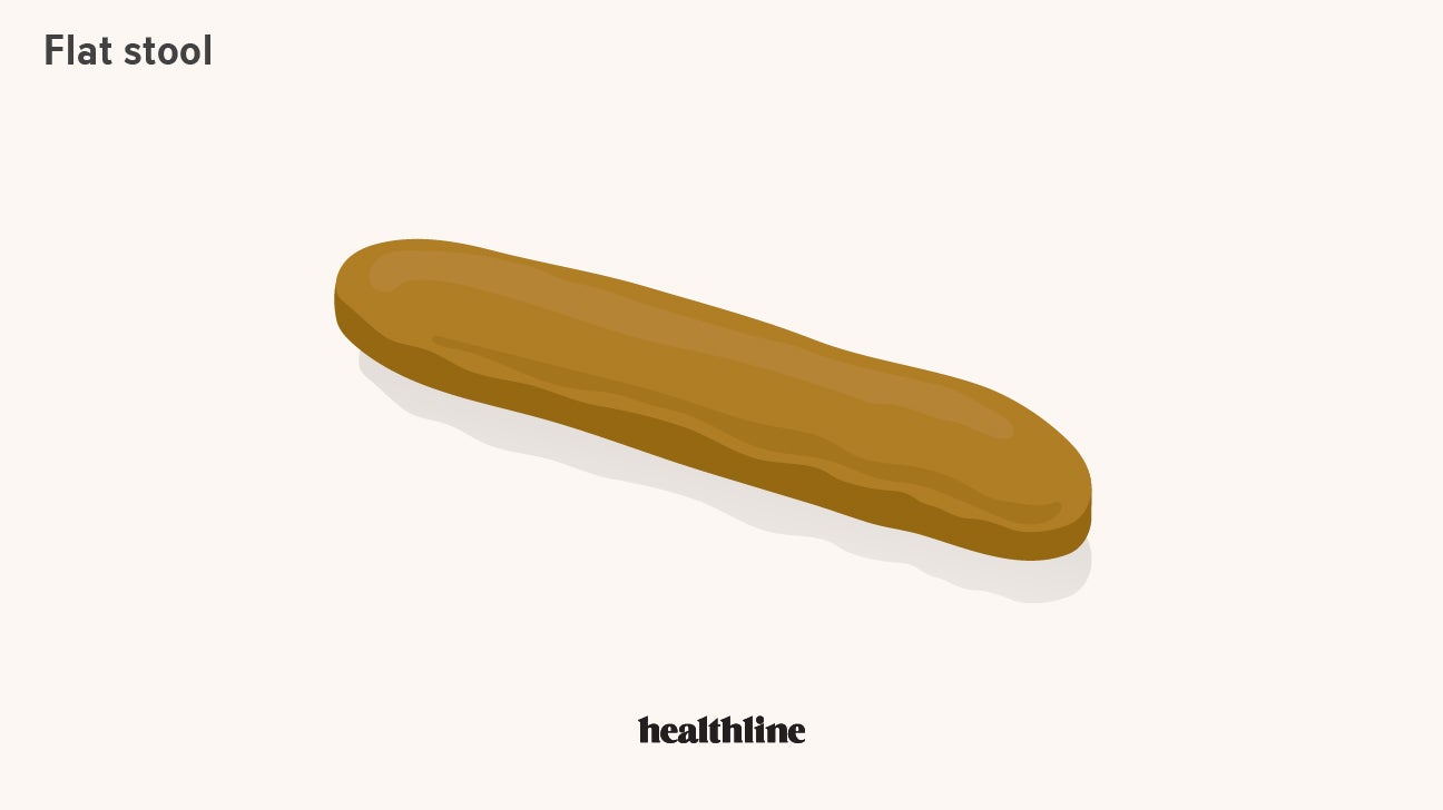 Flat Poop Causes, Home Treatment, When to See a Doctor