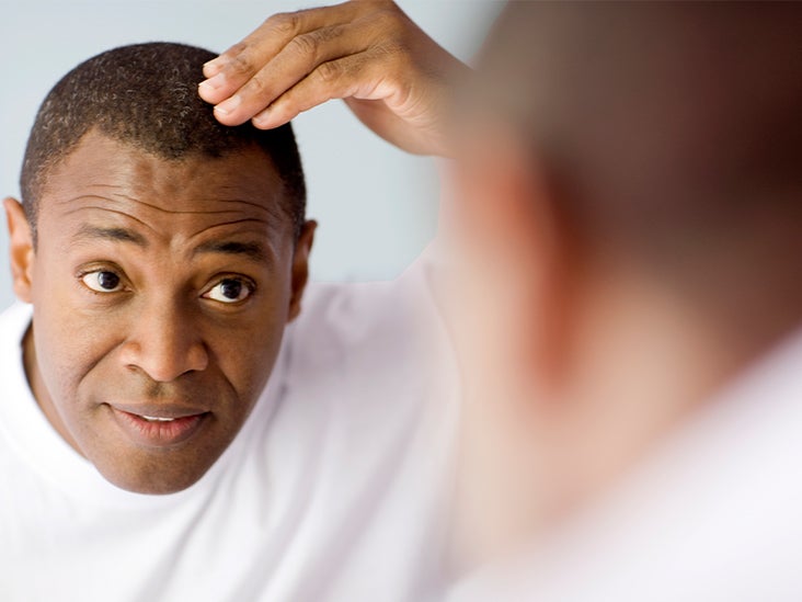 NeoGraft Hair Transplant: Benefits, Side Effects, How it Works