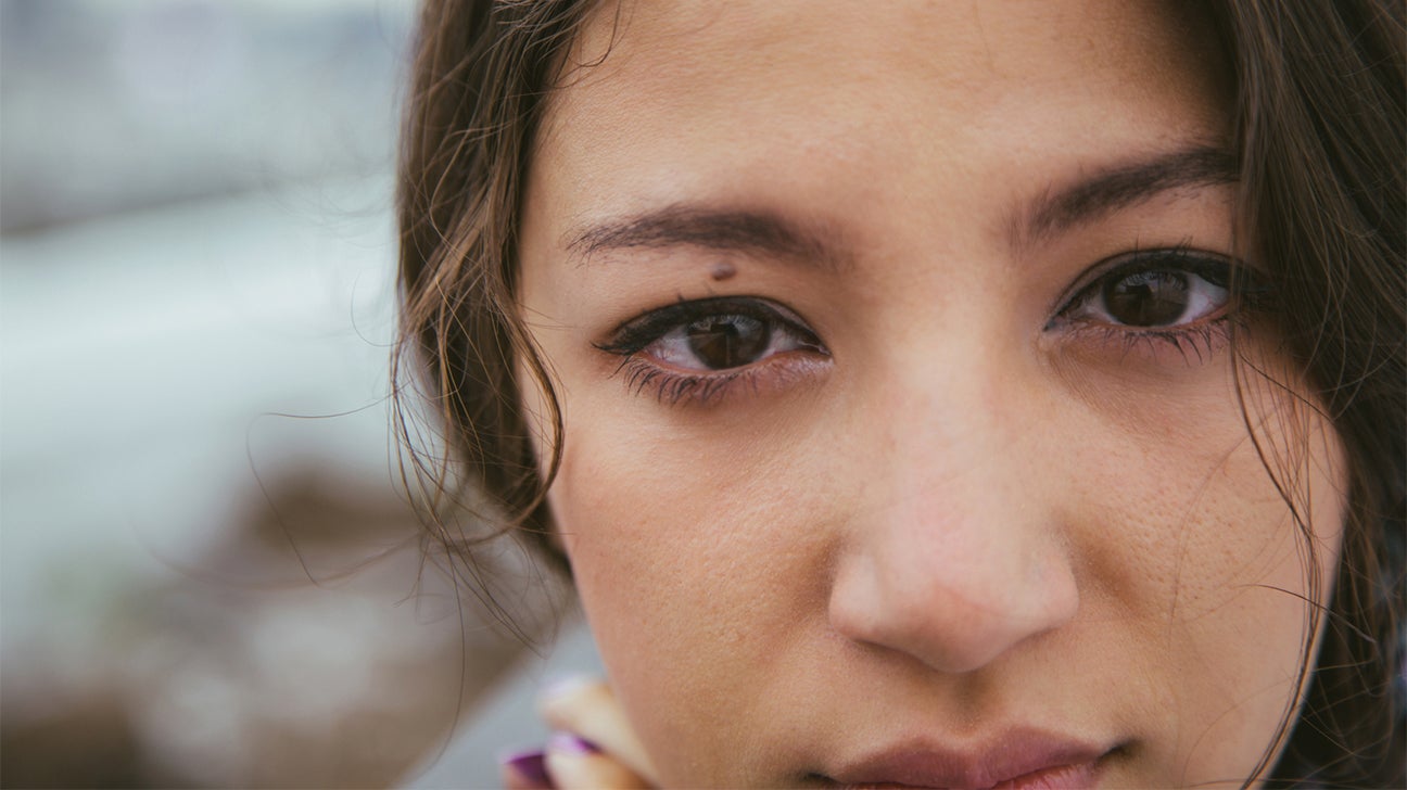 Puffy Eyes: the Causes and How to Get Rid of Them