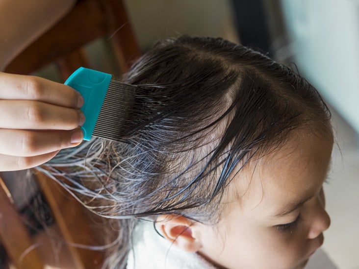 How to Get Rid of Head Lice with Salt: What Works and What Doesn't