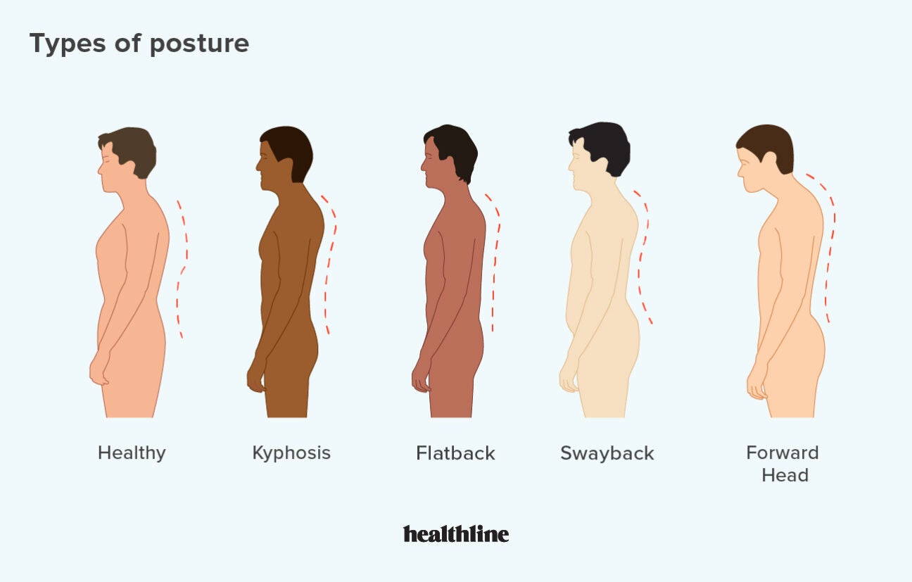 Types Of Posture How To Correct Bad Posture