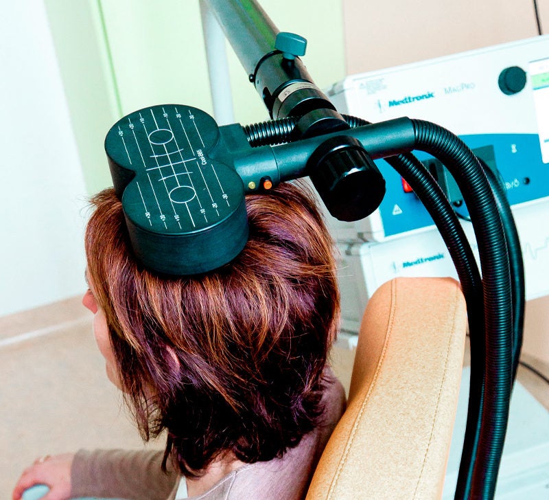 Repetitive Transcranial Stimulation (RTMS): What to