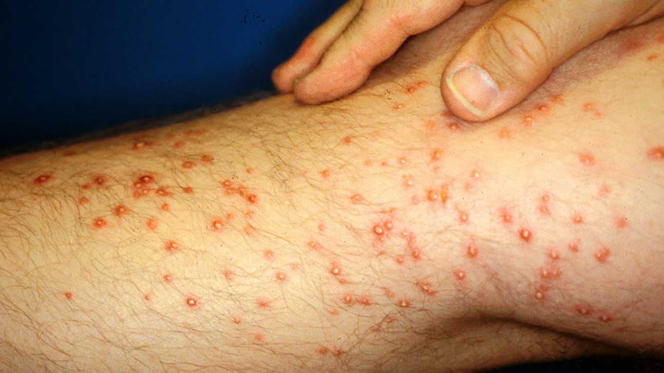 of Red and Spots on Legs