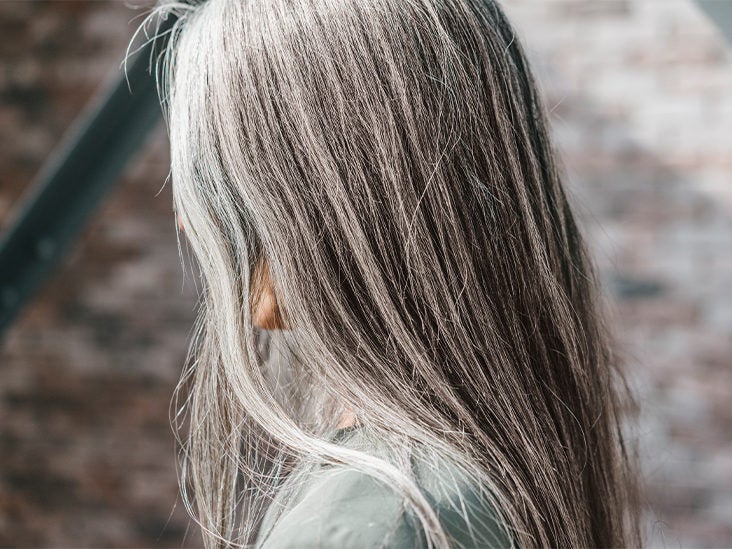 Why this mom and daughter share the same beautiful streak of white hair