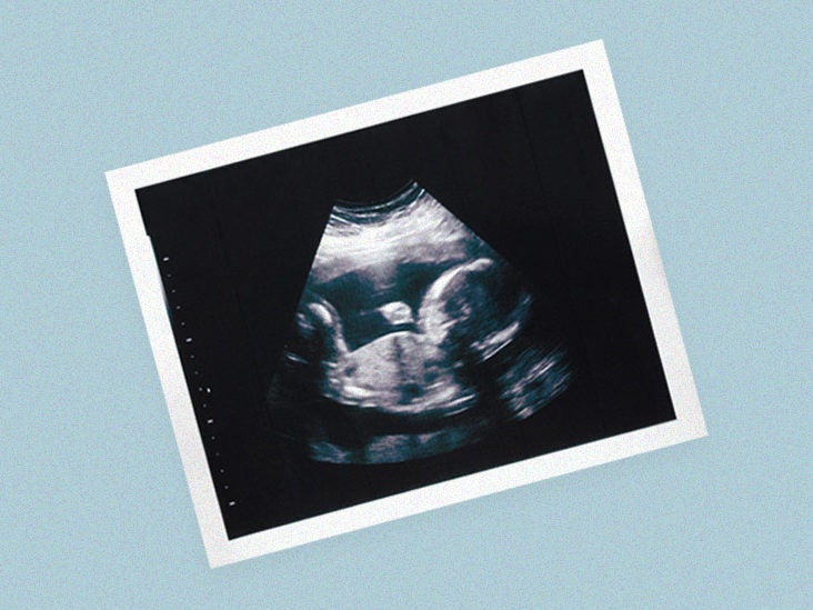 Ultrasound: Purpose, and Preparation