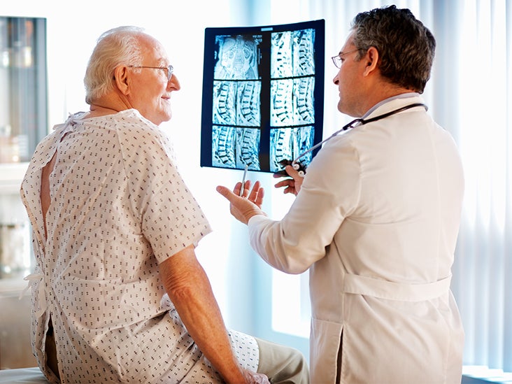 Arachnoiditis: Symptoms, Treatment, Causes and More