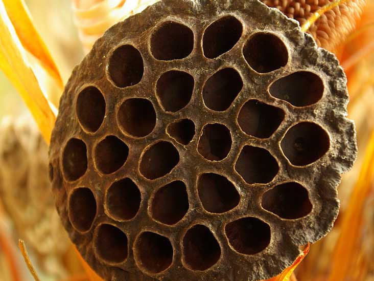 Krankheit trypophobia coolio gangsta's