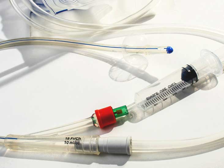 Urinary Catheters Uses Types And Complications