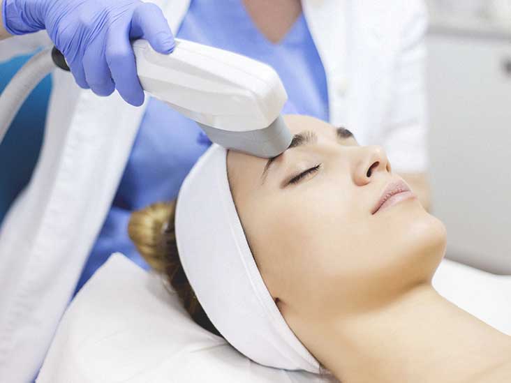 Ipl Treatment Cost Procedure And More