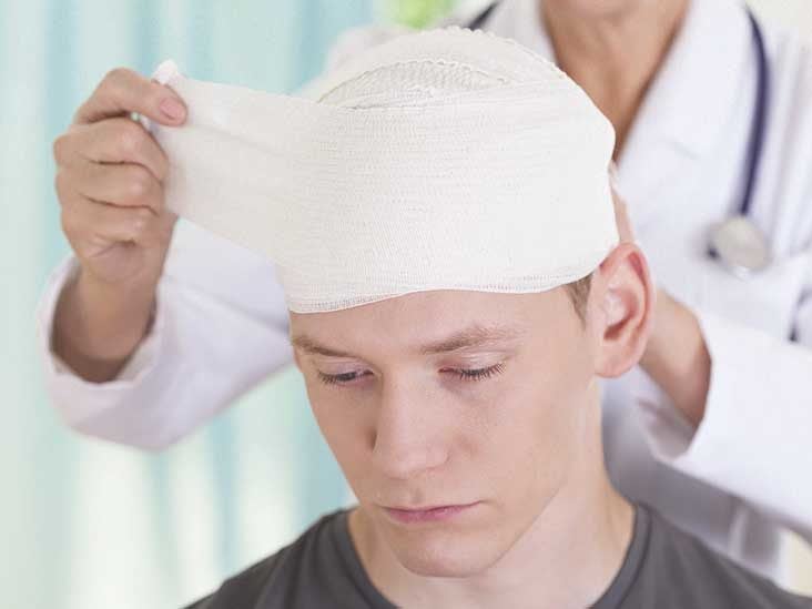 Head Injury: Types, Causes, and Symptoms