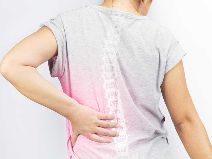 Disc Desiccation Symptoms, Causes, and Treatment