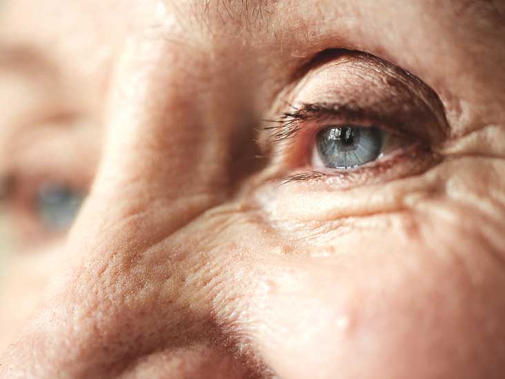 Blepharoplasty Procedure, Efficacy, Safety, and More