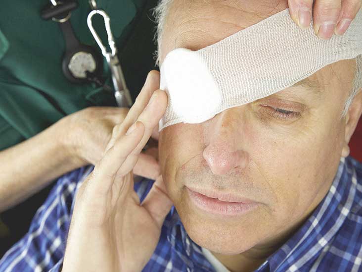 Broken Eye Socket: Picture, Treatment, Recovery