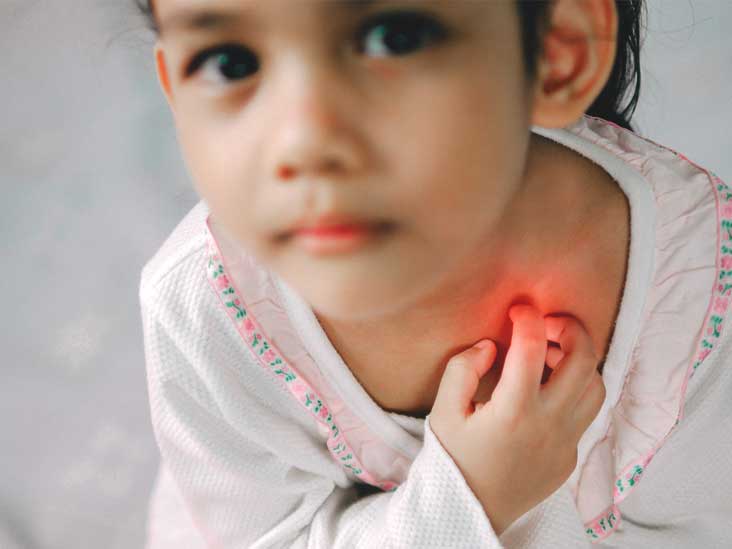 Branchial Cleft Cyst: Causes, Types, and Symptoms