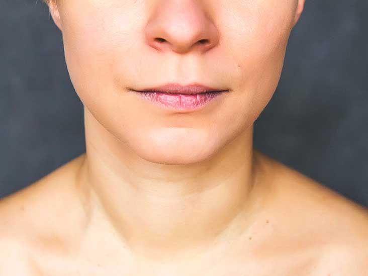 Receding Chin: Pictures, Causes, Exercises, and Surgery