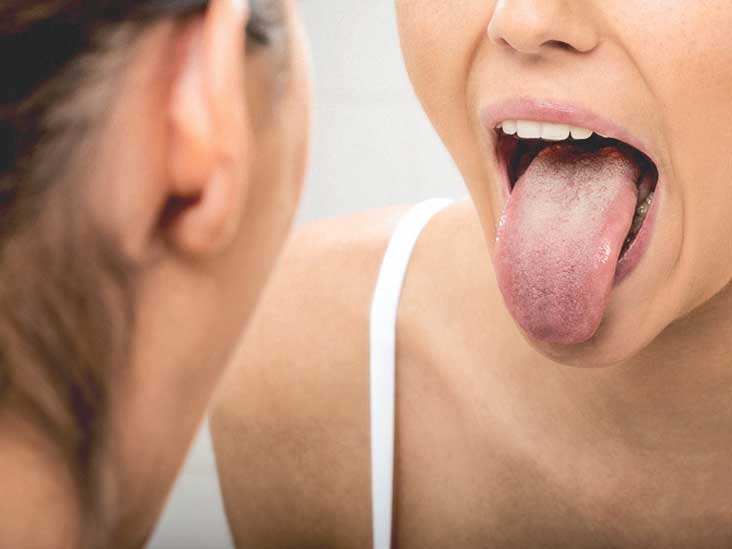 4377 Woman Tongue Mirror 732x549 Thumbnail 