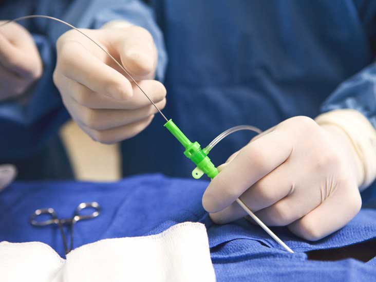 Cardiac Catheterization Uses Stages And Risk Factors