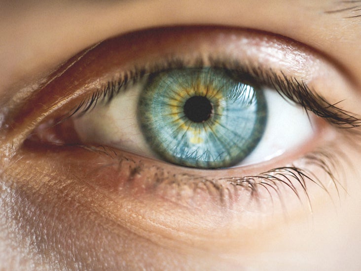 ingenieur betrouwbaarheid proza Central Heterochromia: Definition, Causes, and Types