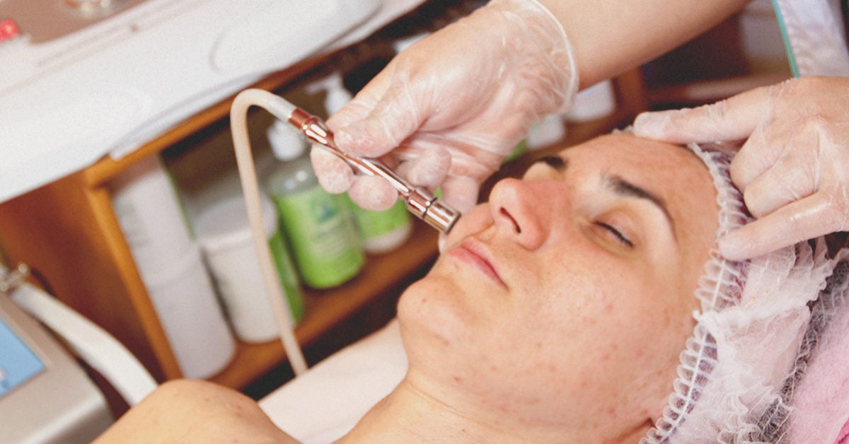 Microdermabrasion for Acne Scars: Benefits, Side Effects, and Cost