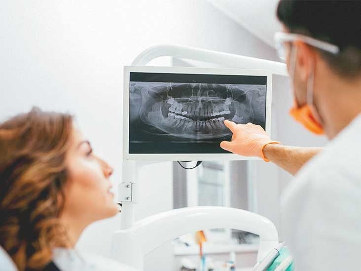  Exposure To Radiation In Intraoral Radiography