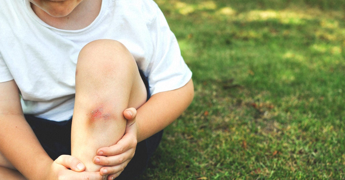 What Can Cause Bruises On Your Legs